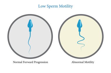 Sperm hareketi, düşük sperm sayısı, sperm analizi, vektör illüstrasyonu E10