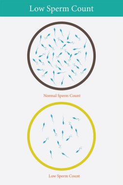 Normal ve düşük sperm sayısı çizimi. 10 saniye.