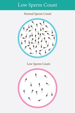 Normal ve düşük sperm sayısı çizimi. 10 saniye.