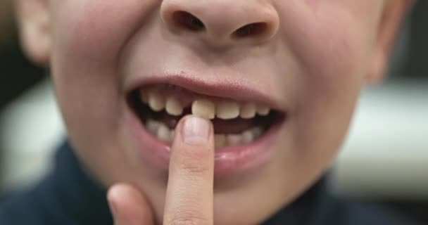 Kid Boy Shows Wobbly Loose Milk Baby Tooth Child Wobbling — Stock Video