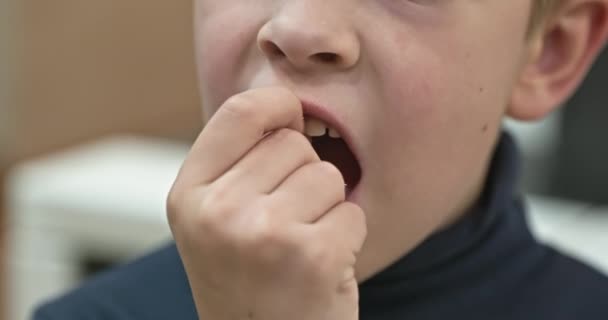 キッズボーイショーは ゆるやかなミルクの赤ちゃんの歯を引き出しました 手指でブロブする子供の歯 10ビット — ストック動画