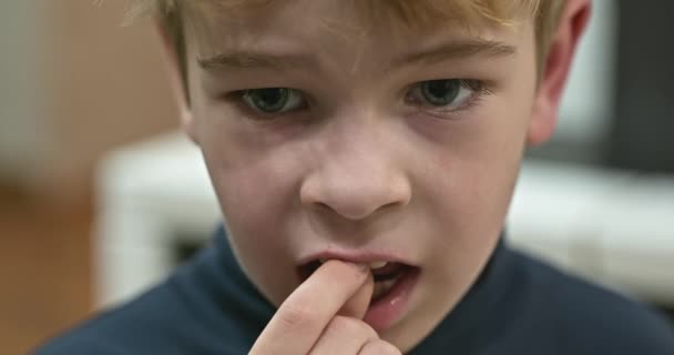 Хлопчик Показує Витягнутий Пухкий Молочний Зуб Дитячий Сліпучий Зуб Ручними — стокове відео