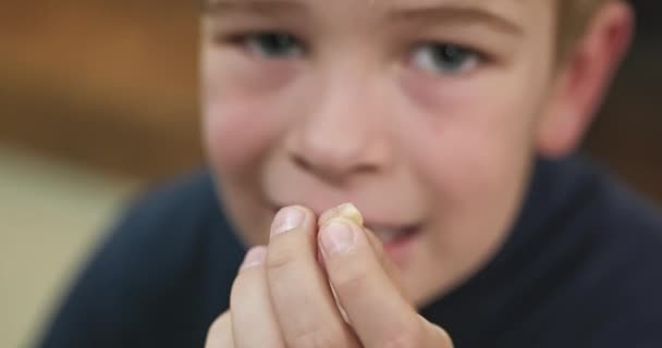 Kid Boy Shows Pulled Out Loose Wobbly Milk Baby Tooth — Stock Video
