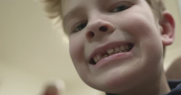 Kid Boy Pokazuje Wyciągnął Luźny Mleczny Ząb Dziecka Dziecko Chwiejące — Wideo stockowe