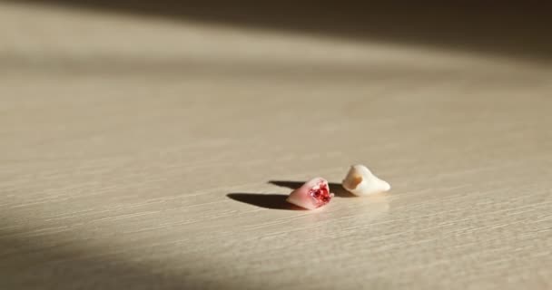 Yakın Plan Bebek Diş Kanla Çekmiş Kayıp Süt Dişleri Masada — Stok video