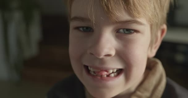 男孩儿露出了丢失的婴儿牙 手牵着的孩子把乳牙拔掉了 4K慢动作10位 — 图库视频影像