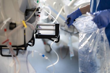 Yoğun bakım hemşiresinin ellerinde hemofiltrasyon makinesi var. 