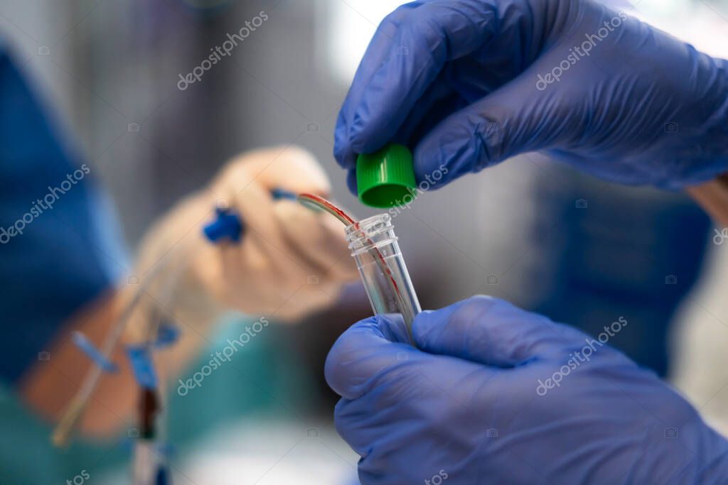 Scientist carefully inserting a blood sample into a test tube, conducting crucial research in a medical laboratory setting