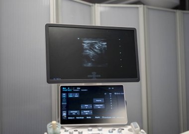 Ultrason cihazı, modern bir hastane odasında ultrason görüntülerini gösteriyor. Tıbbi muayene için hazır.