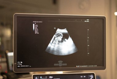 Ultrason monitörü muayene sırasında fetüsü gösteriyor. Hamilelik gelişimine bir göz atıyor.