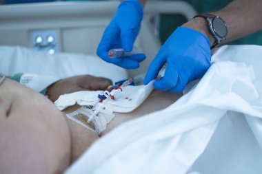 Hastanedeki hastaya merkezi venöz kateter ile ilaç verilmesi.