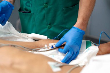 Cerrah, tıbbi prosedür sırasında hastanın ön koluna sıvı değiştirme tedavisi için damar içi kanül yerleştiriyor.