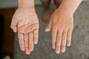 Banyodan sonra bebek ellerine dair detaylı bir bakış açısı. Avuçlar ters istikamette. Yumuşak bebek teni ve ince kırışıklıklar banyo zamanının sıcaklığını ve dinginliğini yansıtır..