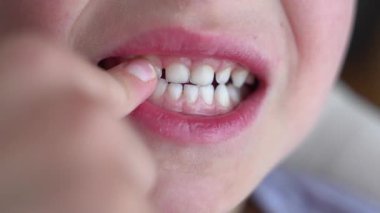Childs 'ın ağzı, dişini gösteren bir parmak ile yakın plan, diş büyümesi ve gelişimi vurguluyor. Bebek dişini kaybeden bir çocuğun merakını ve heyecanını yakalıyor.. 