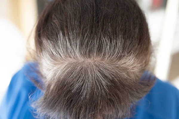 Глава Пожилой Женщины Седыми Волосами Которая Выросла После Окрашивания — стоковое фото