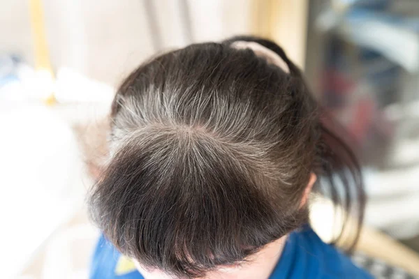Head Elderly Woman Gray Hair Grew Dyeing — Fotografia de Stock