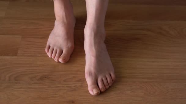 Hallux Valgus Female Legs Background Laminate Flooring Bump Womans Legs — Stock Video