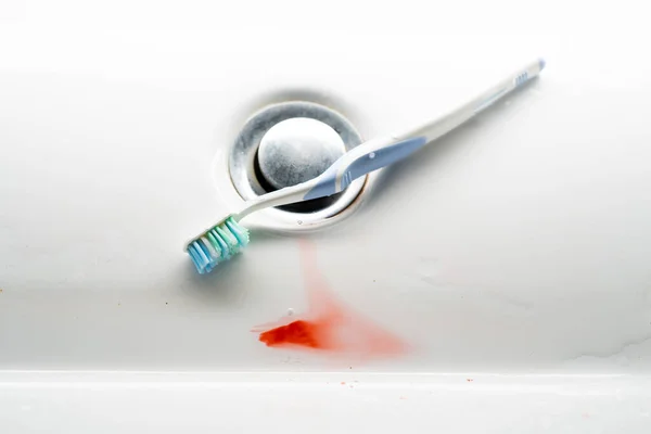 Fogkefe Egy Fehér Mosdókagylóban Vérrel Gumi Probléma — Stock Fotó