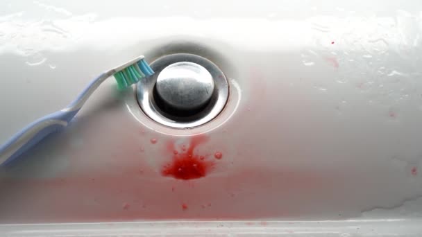 Zahnbürste Einem Weißen Waschbecken Mit Blut Problem Mit Dem Zahnfleisch — Stockvideo