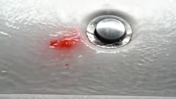 Blutgerinnsel Waschbecken Problem Mit Dem Zahnfleisch — Stockvideo