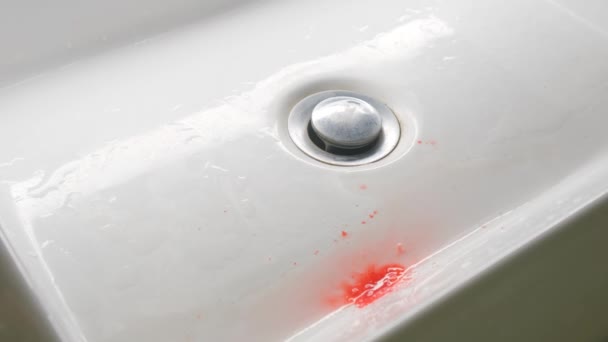 Blood Clot Sink Problem Gums — Stock Video