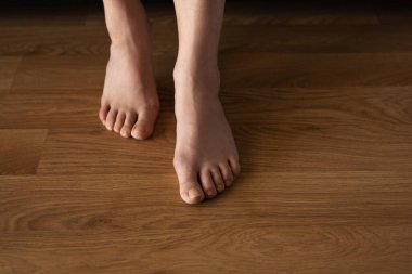 Hallux valgus, arka planda lamine döşeme üzerinde kadın bacakları. Bir kadının bacaklarında şişlik var. Yukarıdan görüntüle.