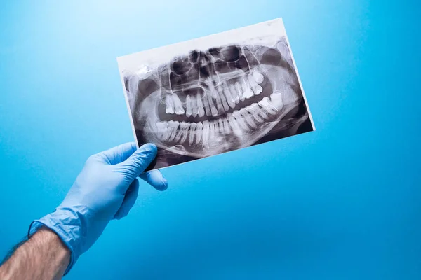 Dentista Segurando Instantâneo Dente Pacientes Indica Problema Tiro Panorâmico Mandíbula — Fotografia de Stock