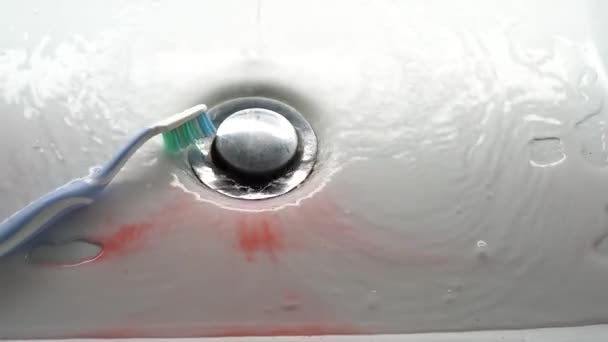 Zahnbürste Einem Weißen Waschbecken Mit Blut Problem Mit Dem Zahnfleisch — Stockvideo