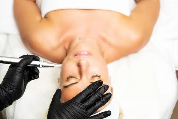 Microneedle Hefprocedure Een Cosmetoloog Voert Een Gezichtsverjonging Procedure Een Vrouw — Stockfoto
