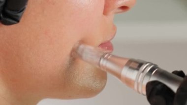 Güzellik uzmanının dermapen 'i ile mikronedling yaparken güzel yaşlı bir kadının yakın plan portresi. Dikey video.