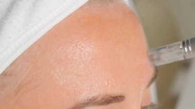 Güzellik uzmanının dermapen 'i ile mikronedling yaparken güzel yaşlı bir kadının yakın plan portresi. Dikey video.
