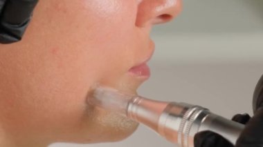 Güzellik uzmanının dermapen 'i ile mikronedling yaparken güzel yaşlı bir kadının yakın plan portresi. Dikey video.