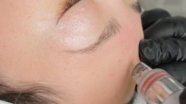 Yakın plan bir kozmetikçi modern bir klinikte hastaların cildini temizlemek ve tazelemek için hidrojen soyma makinesini manipüle ediyor. Dikey video.