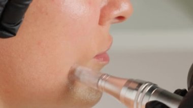 Güzellik uzmanının dermapen 'i ile mikronedling yaparken güzel yaşlı bir kadının yakın plan portresi. Dikey video.