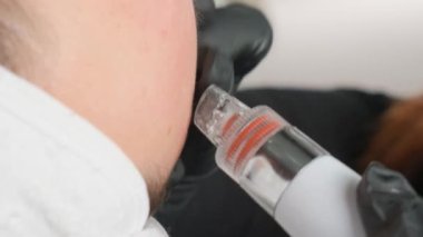 Yakın plan bir kozmetikçi modern bir klinikte hastaların cildini temizlemek ve tazelemek için hidrojen soyma makinesini manipüle ediyor. Dikey video.