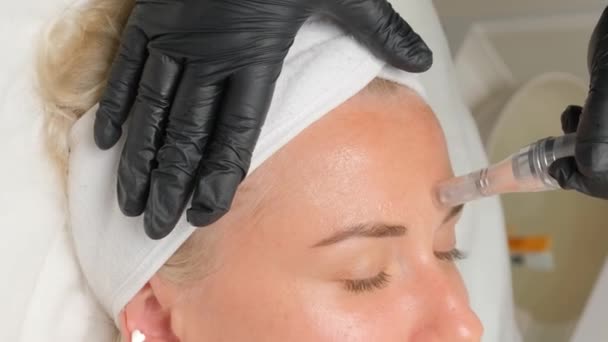 Közelkép Egy Gyönyörű Idős Nőről Mikronézés Közben Dermapennel Egy Kozmetikustól — Stock videók