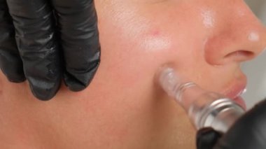 Güzellik uzmanının dermapen 'i ile mikronedling yaparken güzel yaşlı bir kadının yakın plan portresi. Dikey video.