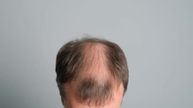 Gri bir arka planda kel genç bir adamın yakın plan fotoğrafı..