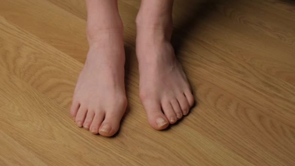 Close Womans Feet Hallux Valgus — Stock Video
