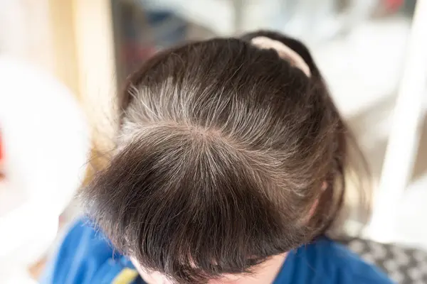 Head Elderly Woman Gray Hair Grew Dyeing Stock Image