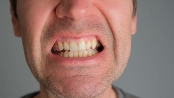 Emotionaler Mann Entblößte Zähne Reizbarkeit Aus Nächster Nähe — Stockvideo