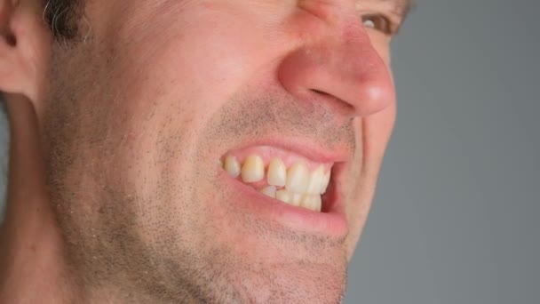 Emocjonalny Mężczyzna Obnażył Zęby Rozdrażnienie Zbliżenie — Wideo stockowe