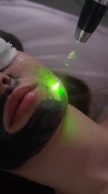 Genç ve güzel bir kızın yüzünün karbonu soyuluyor. Cilt bakımı kozmetolojisi. Lazer terapisi ve cilt tedavisi. Dikey video.