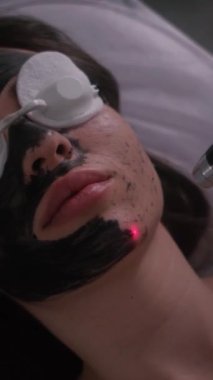 Genç ve güzel bir kızın yüzünün karbonu soyuluyor. Cilt bakımı kozmetolojisi. Lazer terapisi ve cilt tedavisi. Dikey video.