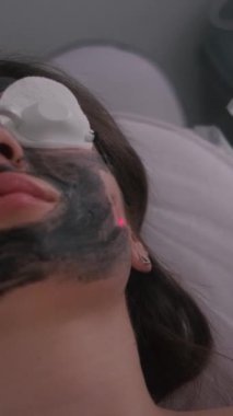 Genç ve güzel bir kızın yüzünün karbonu soyuluyor. Cilt bakımı kozmetolojisi. Lazer terapisi ve cilt tedavisi. Dikey video.