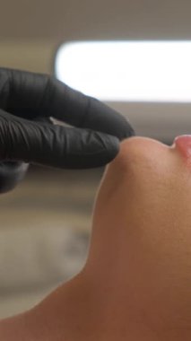 Kadın çenesi yakınındaki şırınga, çene şekli düzeltmesi için doldurulmuş güzellik iğneleri..