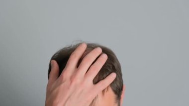 Saç dökülmesi sorunu olan bir adam. Gri arka planda alopesisi olan genç bir adamın yakın çekimi..