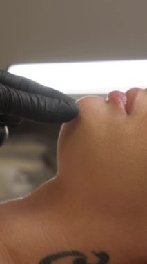 Kadın çenesi yakınındaki şırınga, çene şekli düzeltmesi için doldurulmuş güzellik iğneleri..