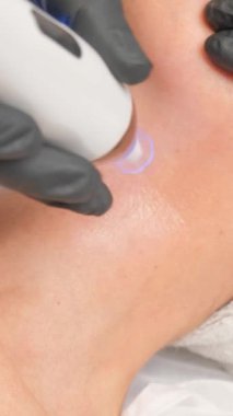 Güzellik uzmanının dermapen 'i ile mikronedling yaparken güzel yaşlı bir kadının yakın plan portresi. Dikey video.