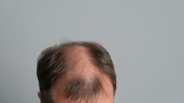 Gri bir arka planda kel genç bir adamın yakın plan fotoğrafı..